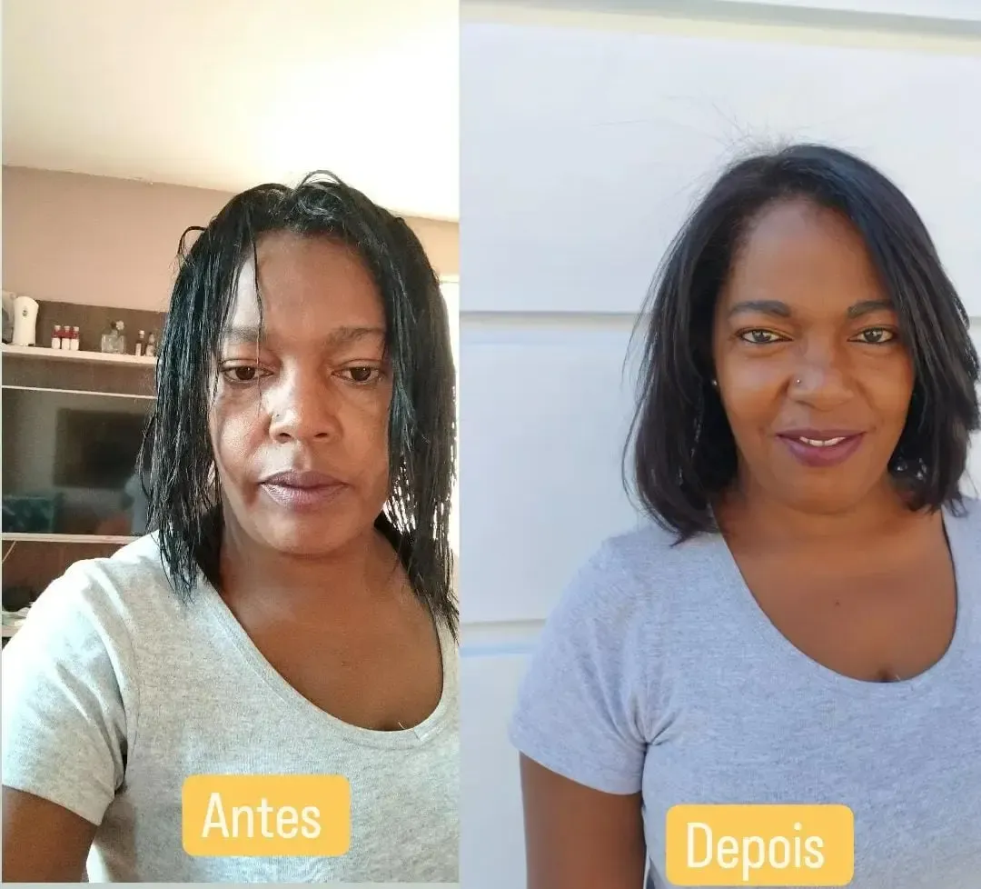 Depois