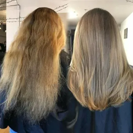 Antes e Depois 2