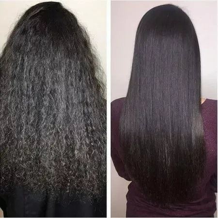 Antes e Depois 3
